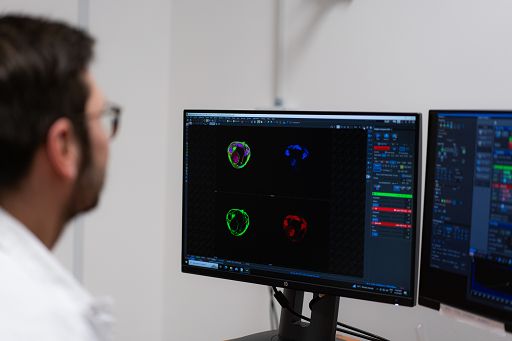 IIT e Polimi: una molecola per stimolare le cellule muscolari con la luce
