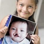 “Impresa Sorriso”, Naos supporta l’impegno di Operation Smile