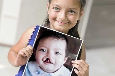 “Impresa Sorriso”, Naos supporta l’impegno di Operation Smile